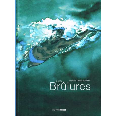 Brûlures (Les) - Les brûlures